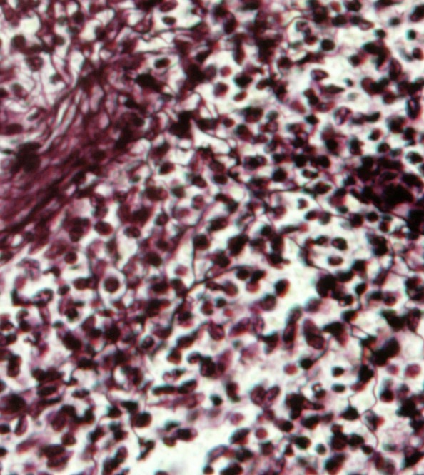 <p>Fibras reticulares </p>