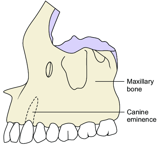 <p><strong>Canine eminence</strong> is the supporting <strong>bony ridge</strong> on the <strong>facial surface of the maxilla</strong> overlying the <strong>root of the maxillary canine</strong>.</p><ul><li><p>Created by the <strong>long, thick root</strong> of the canine</p></li></ul><p></p>