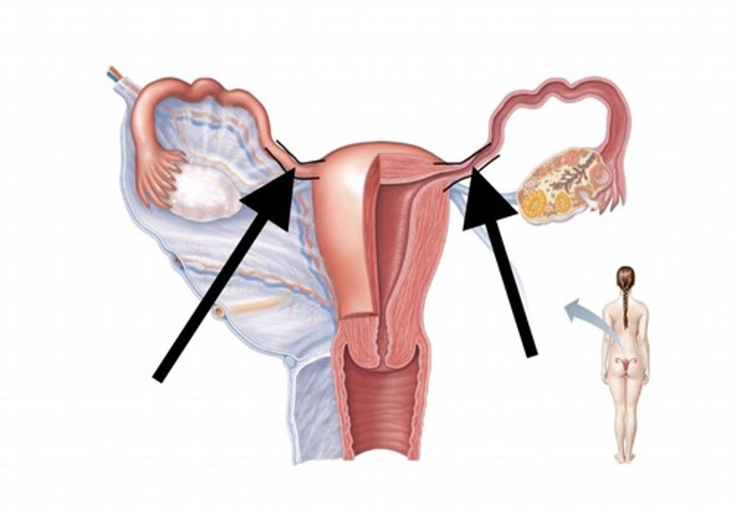 <p>adjacent to uterine wall</p>