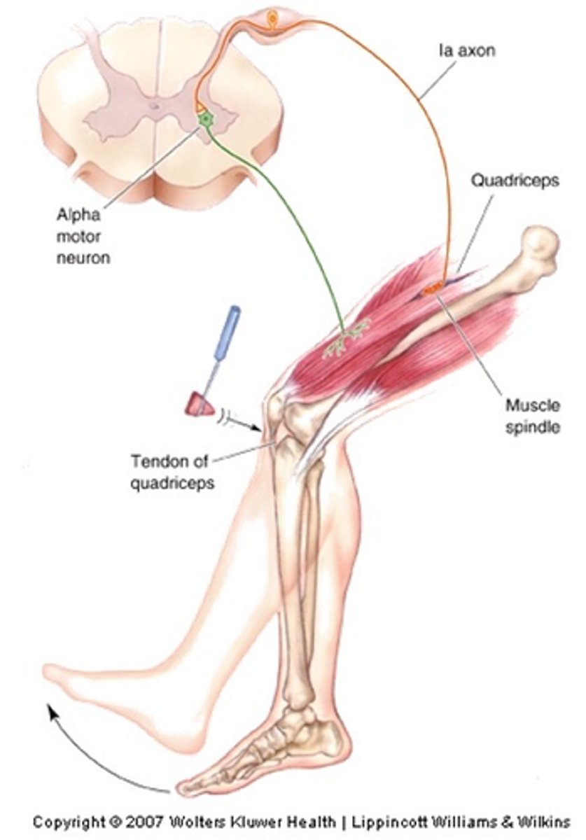 <p>Muscle spindles are among the body's _____________ - sense organs that monitor the _____________ and _______________ of body parts</p>