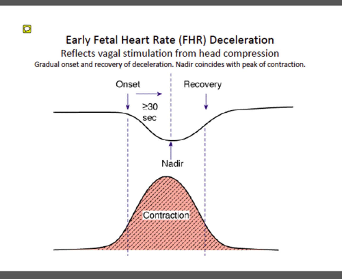 <p>decel: benign, associated w/ head compression; start, nadir &amp; end mirrors ctx</p>