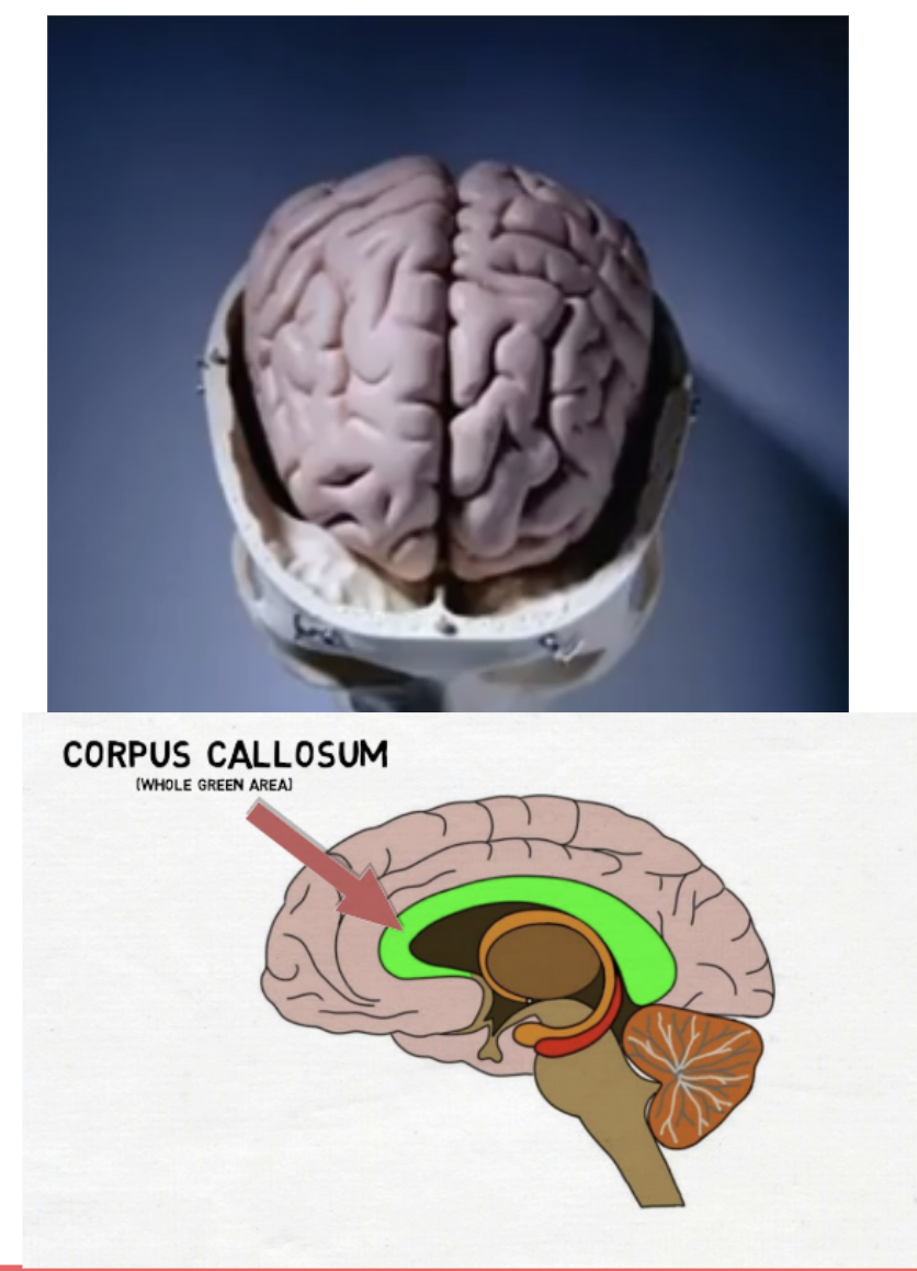 <p><span style="background-color: transparent;"><span>The band of nerve tissue that connect the left and right hemispheres</span></span></p>