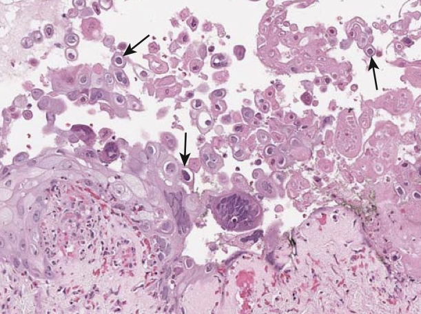 term image
