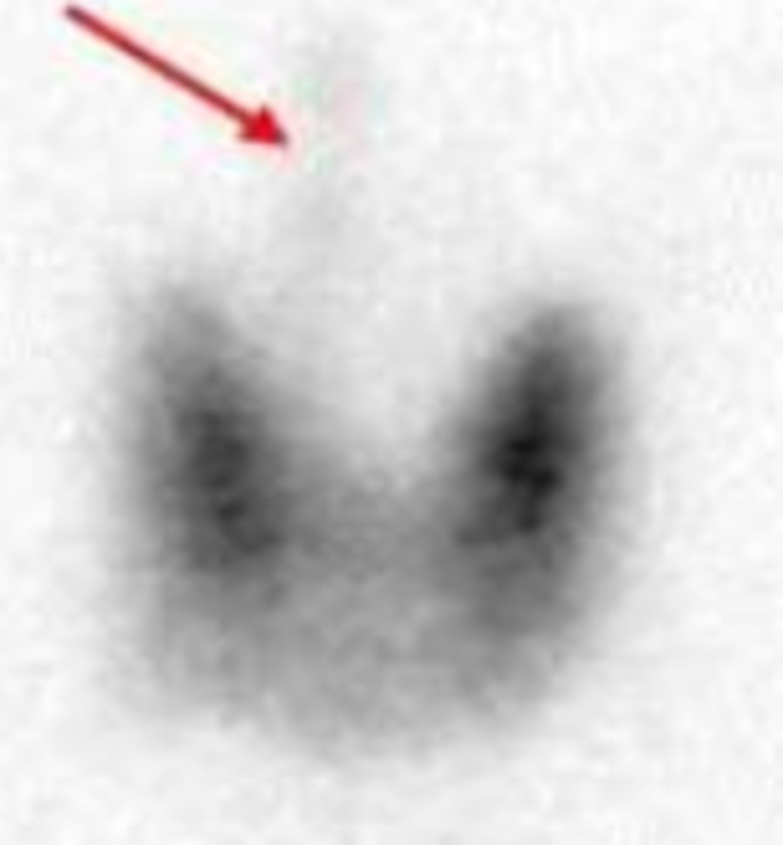 <p>What does this image indicate?</p>