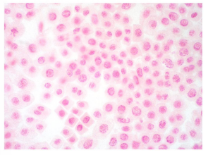 <p>Nuclei in interphase</p><p>staining : feulgen</p><p>features : nucleus is red</p>
