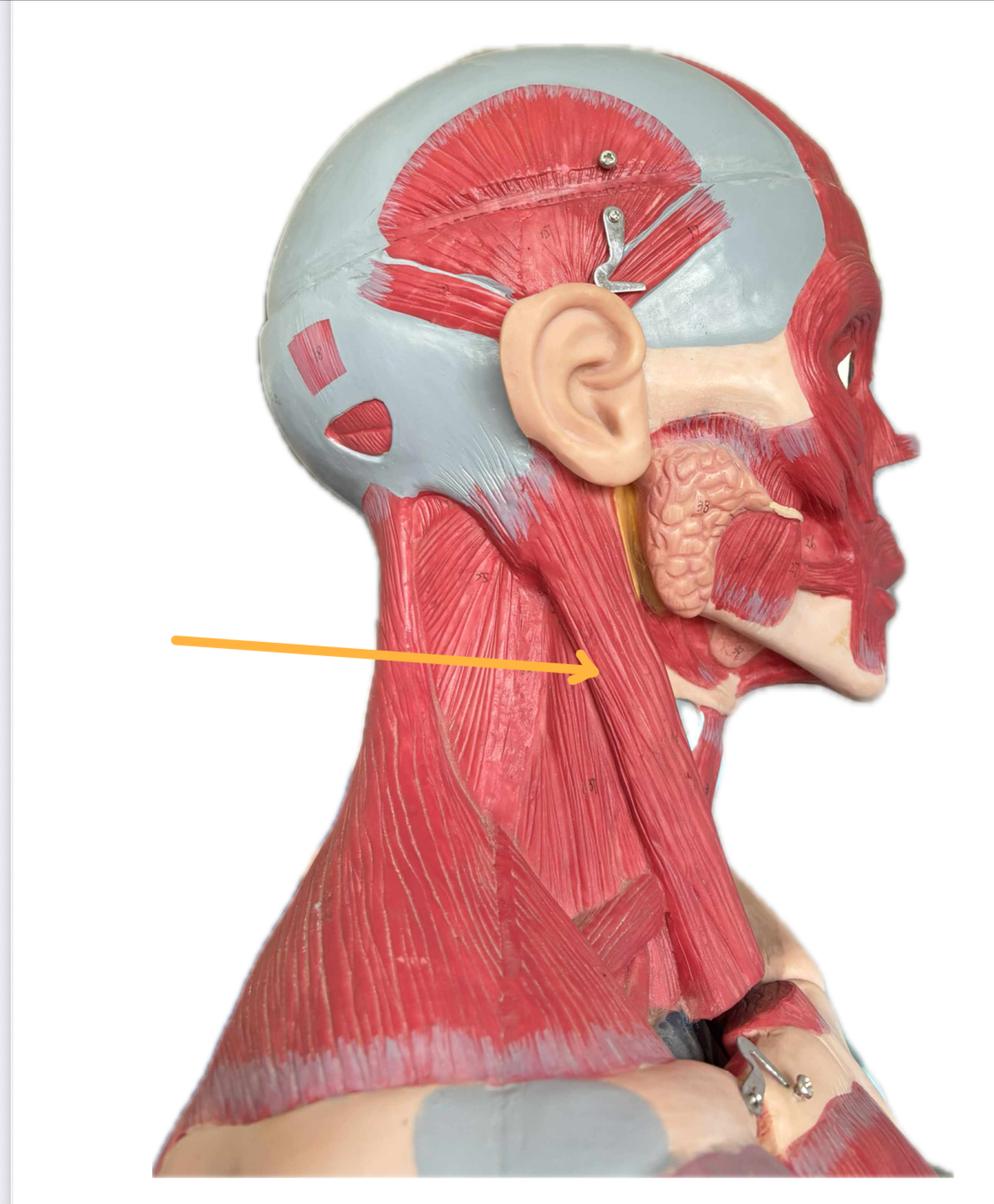term image