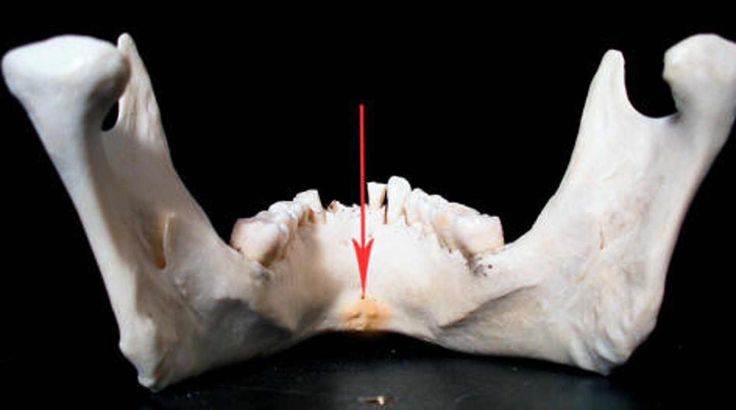 <p>what is this structure and what attaches here</p>