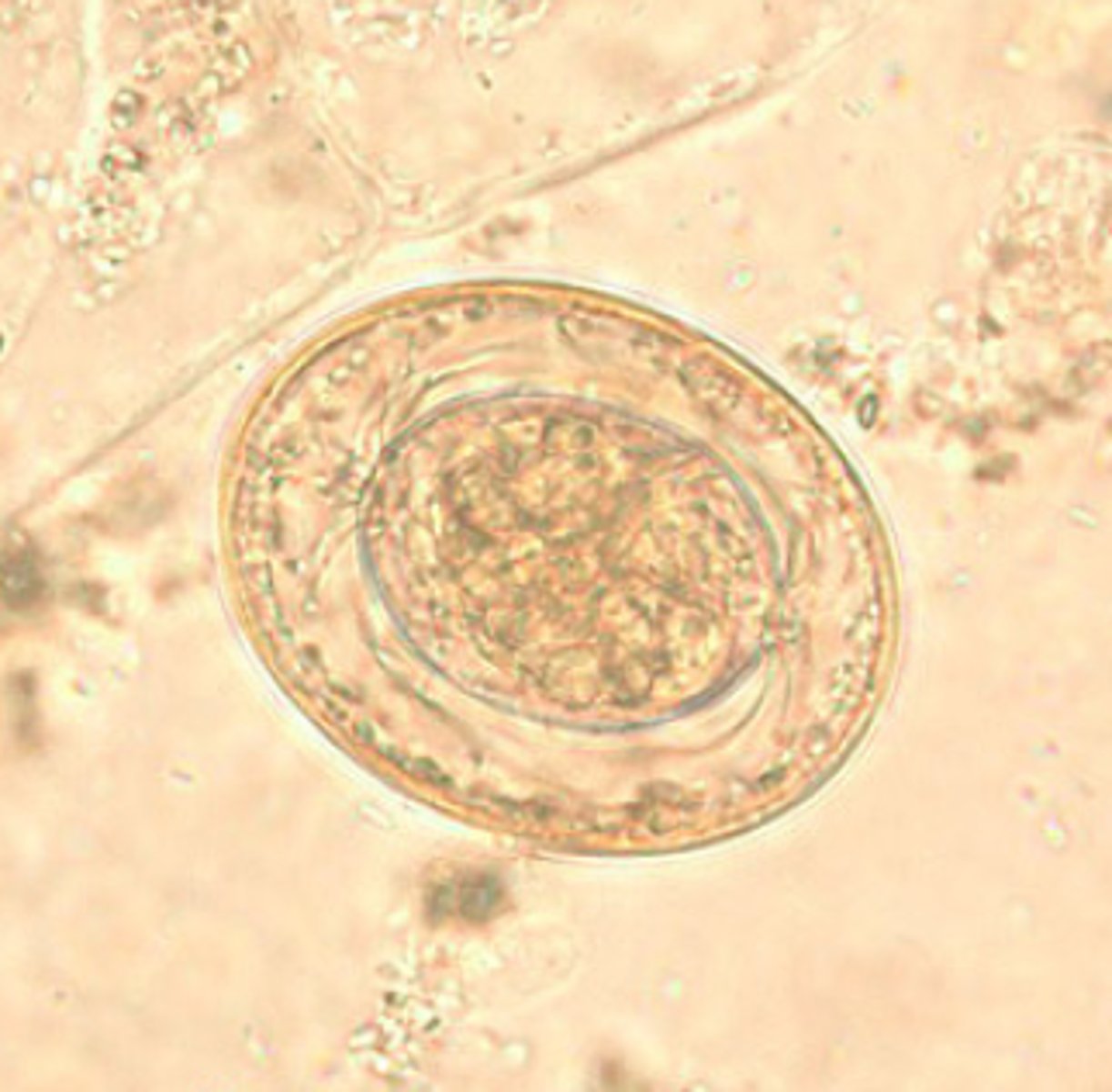 <p>*colorless shell<br>*filaments are emerging from the polar thickenings</p>