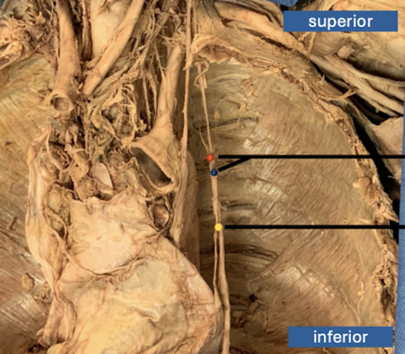 <p>vein</p>
