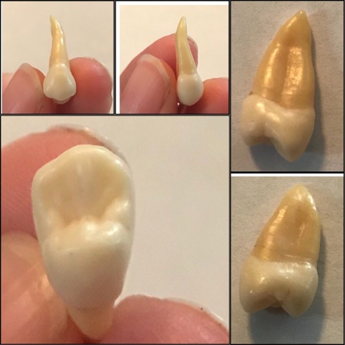 <p>What tooth is this ?</p>