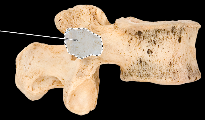 <p>What part of the vertebra is highlighted?</p><p>What type of vertebra is this (which region is this vertebra from)?</p><p>(Lateral view, right side).</p>