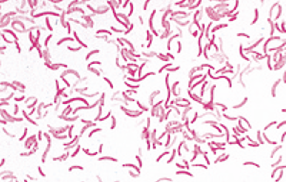 Rhodospirillum rubrum 
