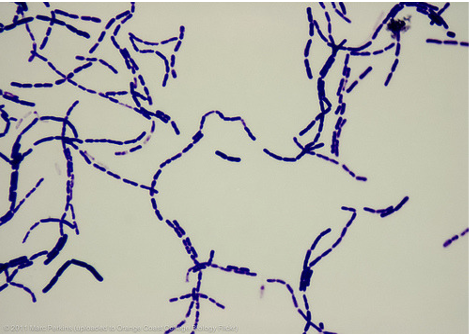 Bacillus cereus (simple stain)