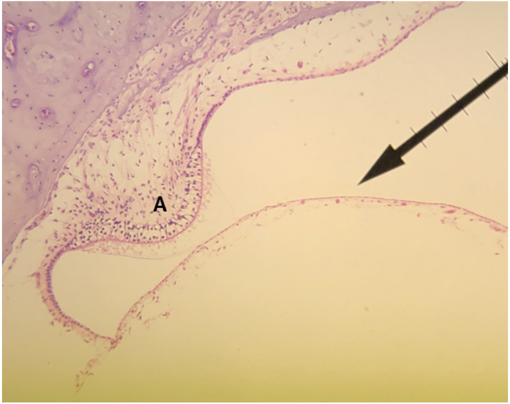 <p><span><span>In the image above, identify structure A.</span></span></p>