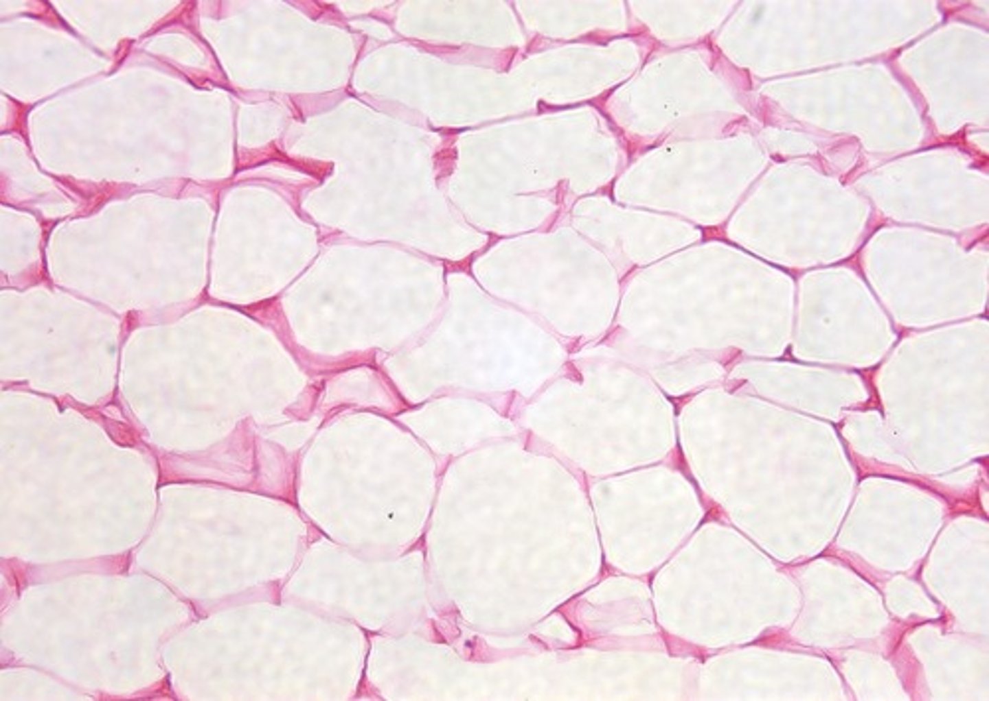 <p>Sparse matrix; closely packed fat cells; Cells: Adipocytes; Function: Energy storage, insulation, cushioning; Location: Under skin, around organs, eyeballs, kidneys.</p>