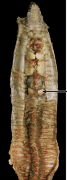 <p>Name this thick walled muscular structure found in the earthworm.</p>