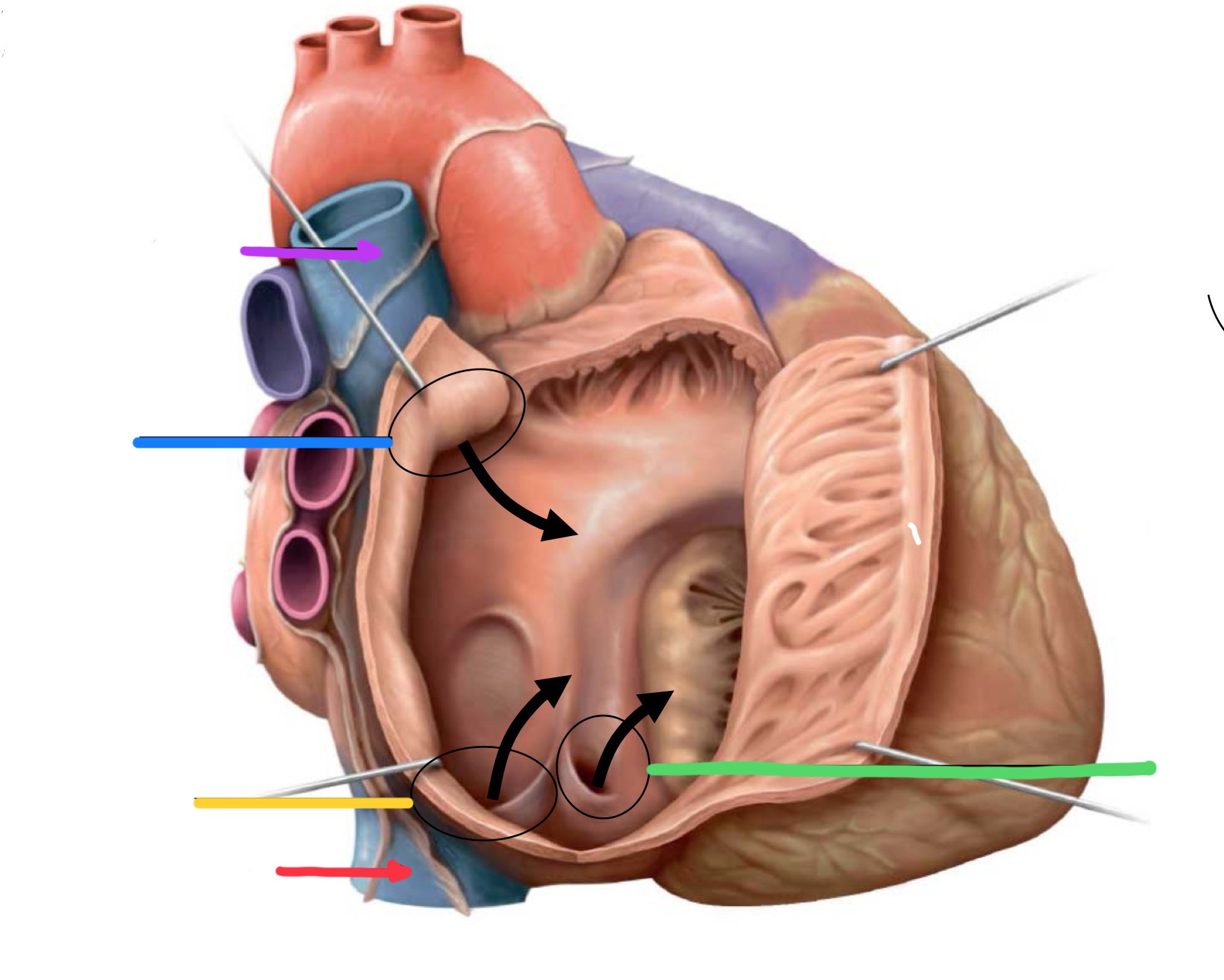 <p>What structure is identified by the blue line?</p>