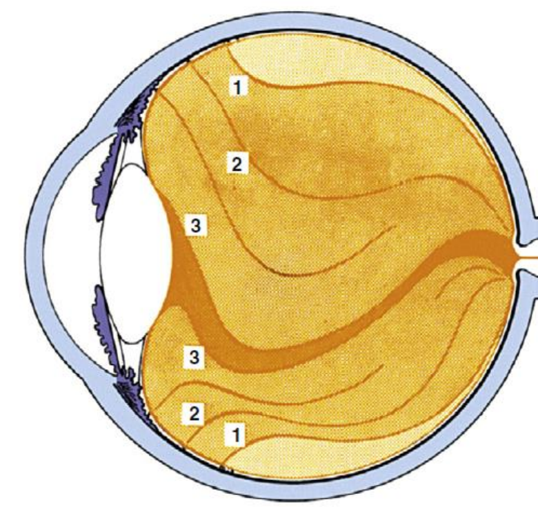 <ol><li><p><strong>Vitreous Cortex</strong></p><ul><li><p>AKA:<strong> Hyaloid Surface </strong></p></li><li><p><strong>Outer </strong>zone </p></li><li><p>Tightly packed collagen fibrils </p><ul><li><p><strong>Parallel + perpendicular to retinal surface </strong></p></li></ul></li><li><p><strong>Anterior Vitreous Cortex: </strong></p><ul><li><p>Anterior to vitreous base </p></li><li><p>Adjacent to CB, posterior chamber, + lens</p></li></ul></li><li><p><strong>Posterior Vitreous Cortex </strong></p><ul><li><p>Posterior to vitreous base </p></li><li><p>In <strong>contact with the retina </strong></p></li><li><p>Contains transvitreal channels that appear as holes</p></li></ul></li><li><p>Posterior Vitreous Cortex: <strong>Transvitreal Channels </strong></p><ul><li><p><strong>Prepapillary hole </strong></p></li><li><p><strong>Premacular hole </strong></p></li><li><p><strong>Prevascular fissures</strong></p></li></ul></li></ul></li><li><p><strong>Intermediate Zone</strong></p><ul><li><p>Continuous + <strong>unbranched </strong>fine fibers </p></li><li><p>Run <strong>anteroposteriorly </strong></p></li><li><p>Aris<strong>e near vitreous base</strong>, insert <strong>into posterior cortex </strong></p></li><li><p>Vitreous tracts </p><ul><li><p>Areas having different fiber densities</p></li></ul></li></ul></li><li><p><strong>Cloquet’s Canal</strong></p><ul><li><p>AKA <strong>hyaloid channel, retrolental tract </strong></p></li><li><p><strong>Center </strong>of vitreous body </p></li><li><p><strong>Former site of hyaloid artery system </strong></p></li><li><p>Arises in <strong>retrolental space </strong></p></li><li><p>Terminates in <strong>area of Martegiani </strong></p><ul><li><p>Funnel-shaped space at optic nerve</p></li></ul></li></ul></li></ol><p></p>