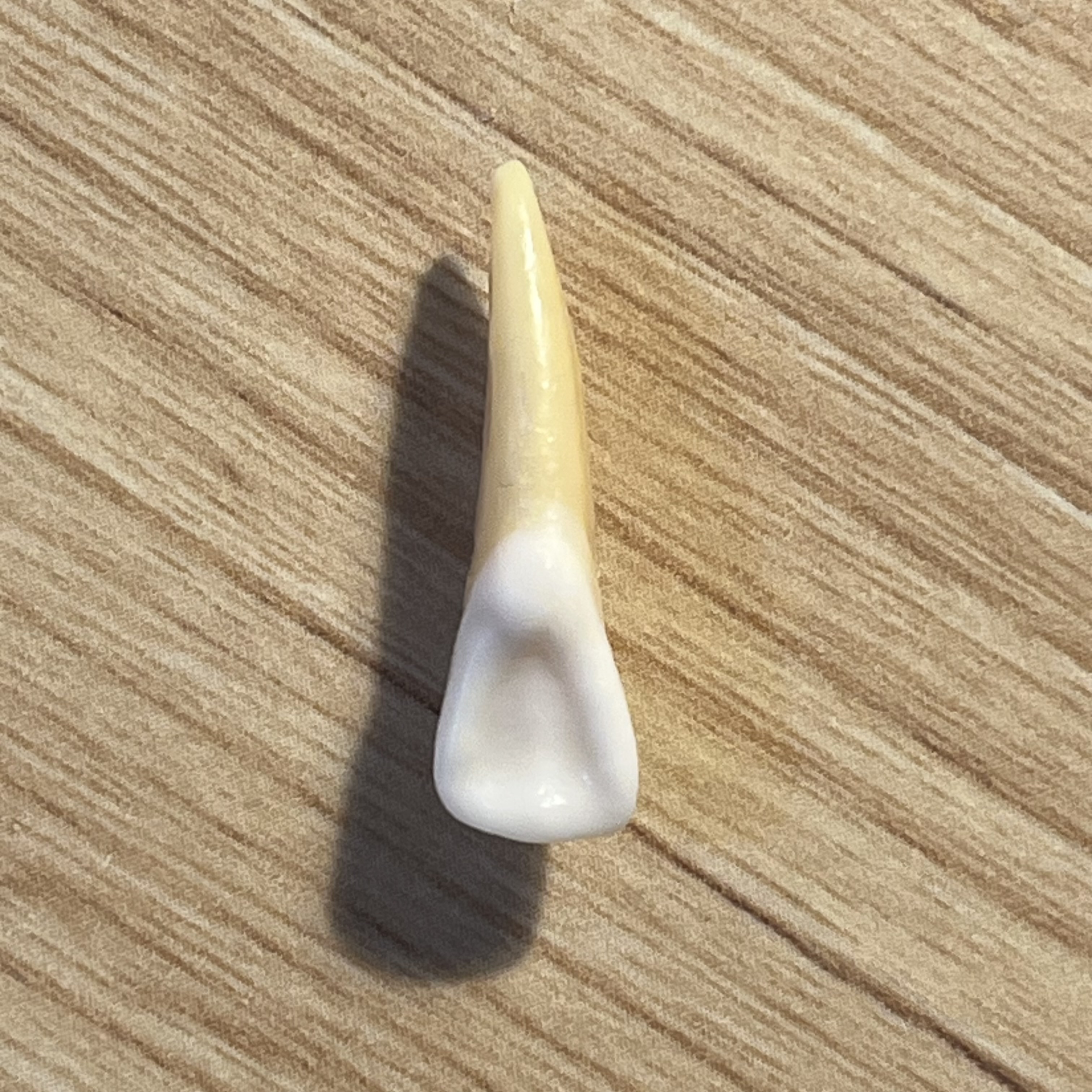 <p>What tooth is this (with view)?</p>