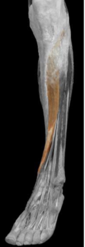 <p>Tibialis anterior </p>