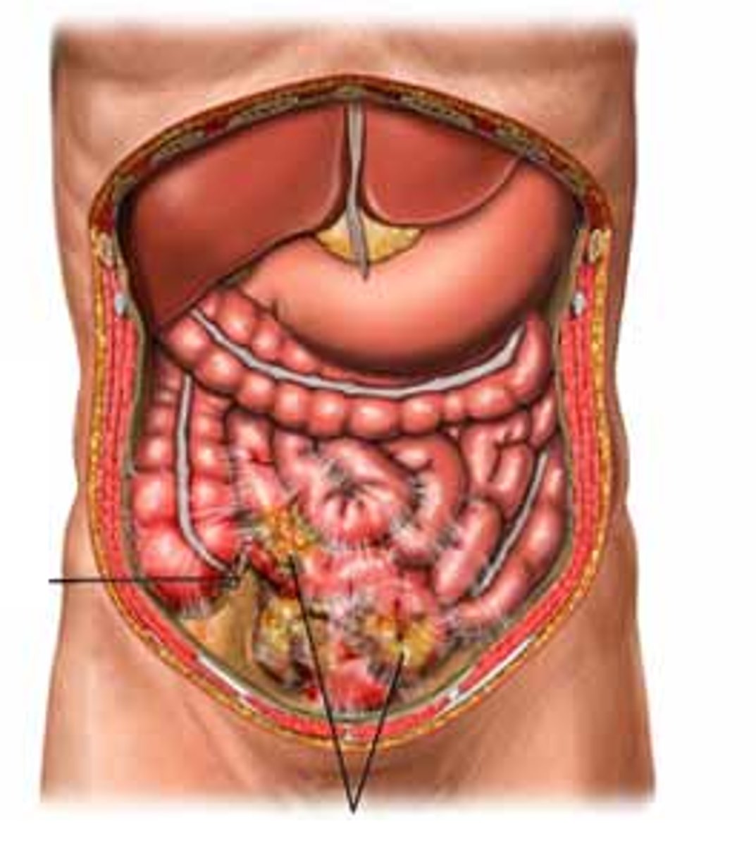 <p>-Location:</p><p>Abdominal region</p><p>-Description:</p><p>Bounded by abdominal walls, thoracic diaphragm (superior), and pelvic brim (inferior)</p><p>Major organs include: stomach, intestines, liver, gallbladder, spleen, pancreas, kidneys and ureters, suprarenal glands, aorta, inferior vena cava, and lumbar nerve plexus</p>