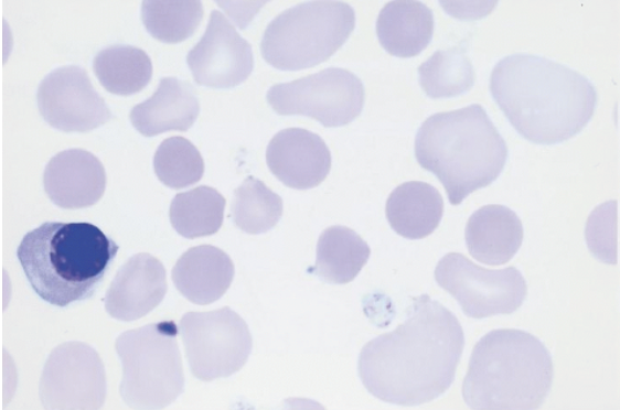 <p>what disease/condition is associated with increase nRBCs and polychromasia?</p>