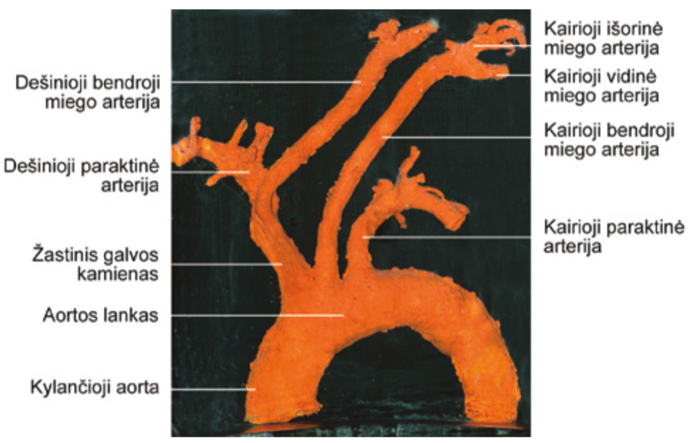 <p>Kokios yra aortos dalys?</p>