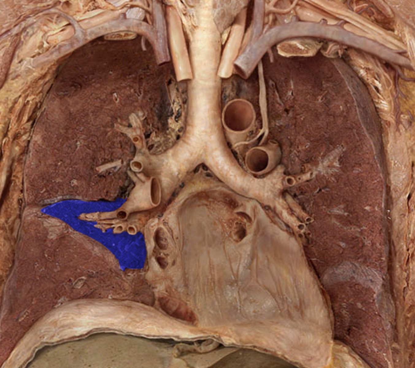 <p>Label the Lung Segment</p>