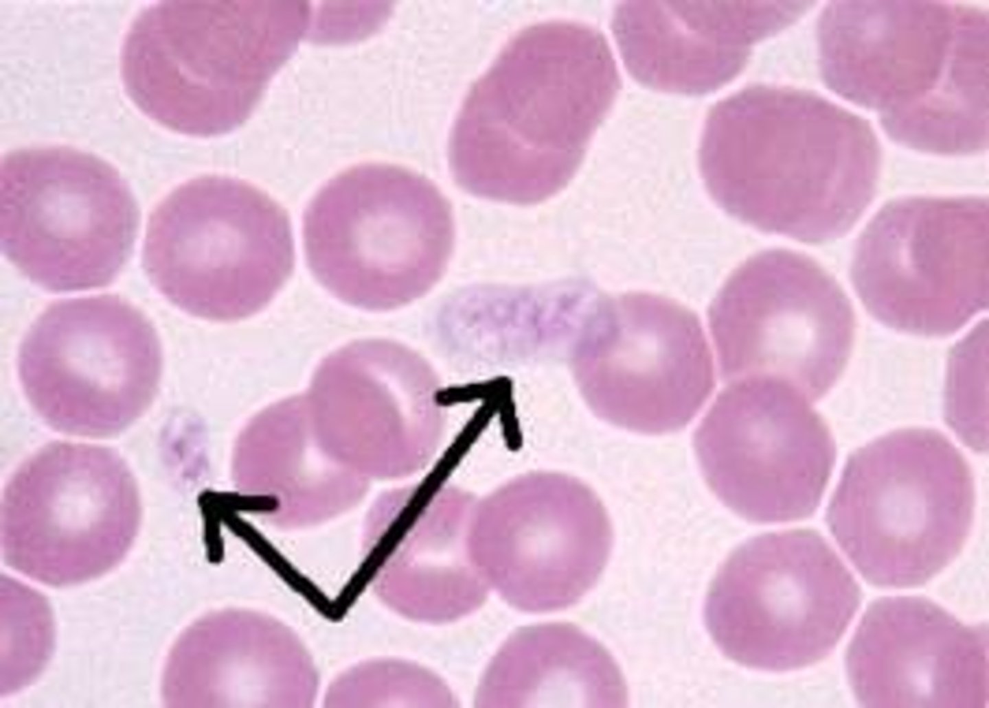 <p>Cell fragments in blood that help prevent blood loss.</p>