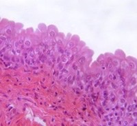 What type of epithelia? Where could it be located?