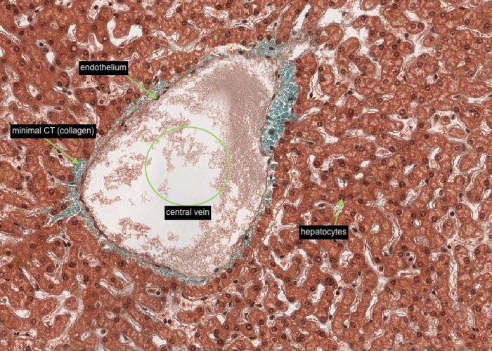 Liver - central vein (Massons)