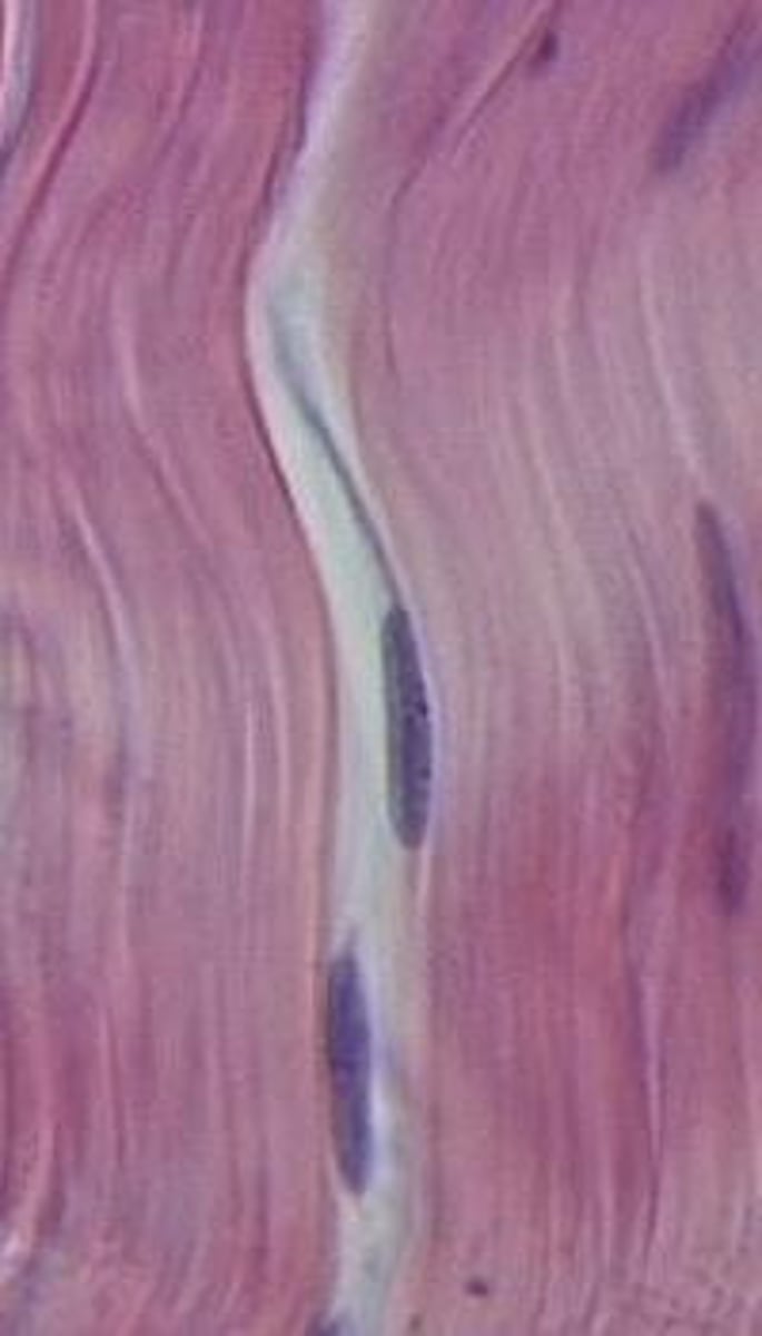 <p>a group of similar cells that perform a common function</p>