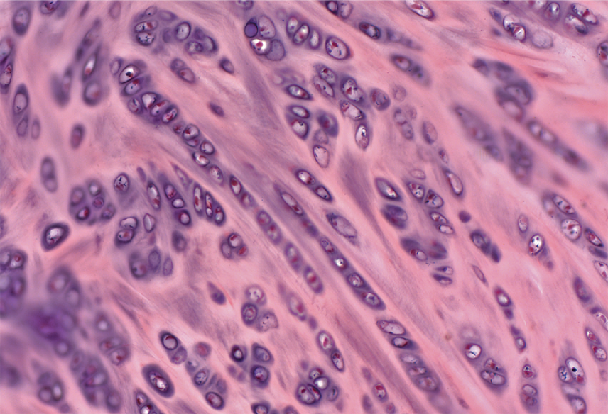 <p><span style="font-family: Calibri">Cartilage containing large, coarse bundles of collagen fibers and fibroblasts; resists compression and absorbs shock; found in the pubic symphysis, menisci, and intervertebral discs</span></p>