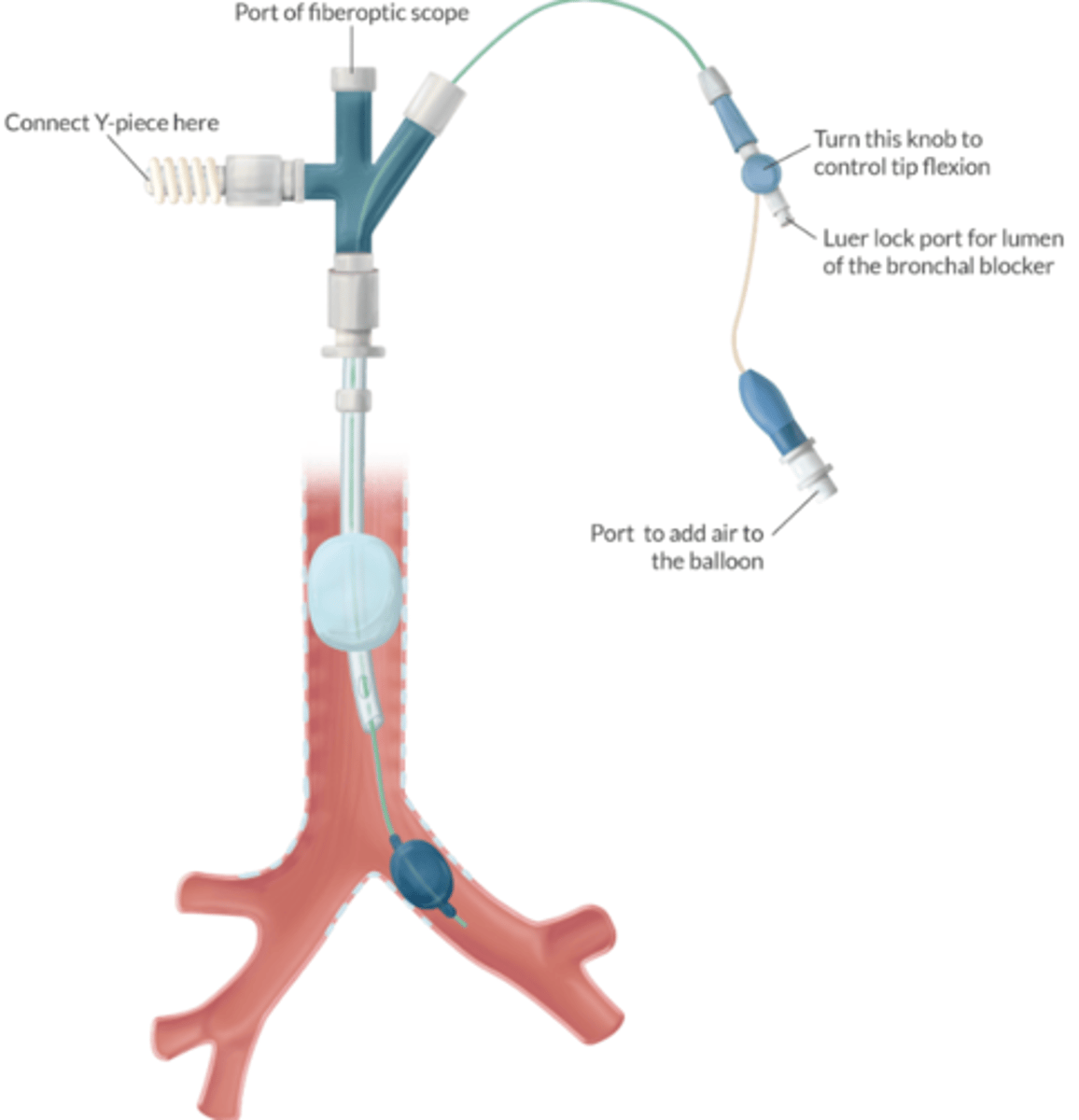 <p>USE: </p><p>-insufflate O2 into nonventilated lung</p><p>-suction air from nonventilated lung (improves surgical exposure)</p><p>DO NOT USE:</p><p>-ventilate</p><p>-suction blood, pus, or secretions from the non-ventilated lung </p>