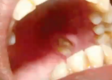 <p>diagnosis?</p>