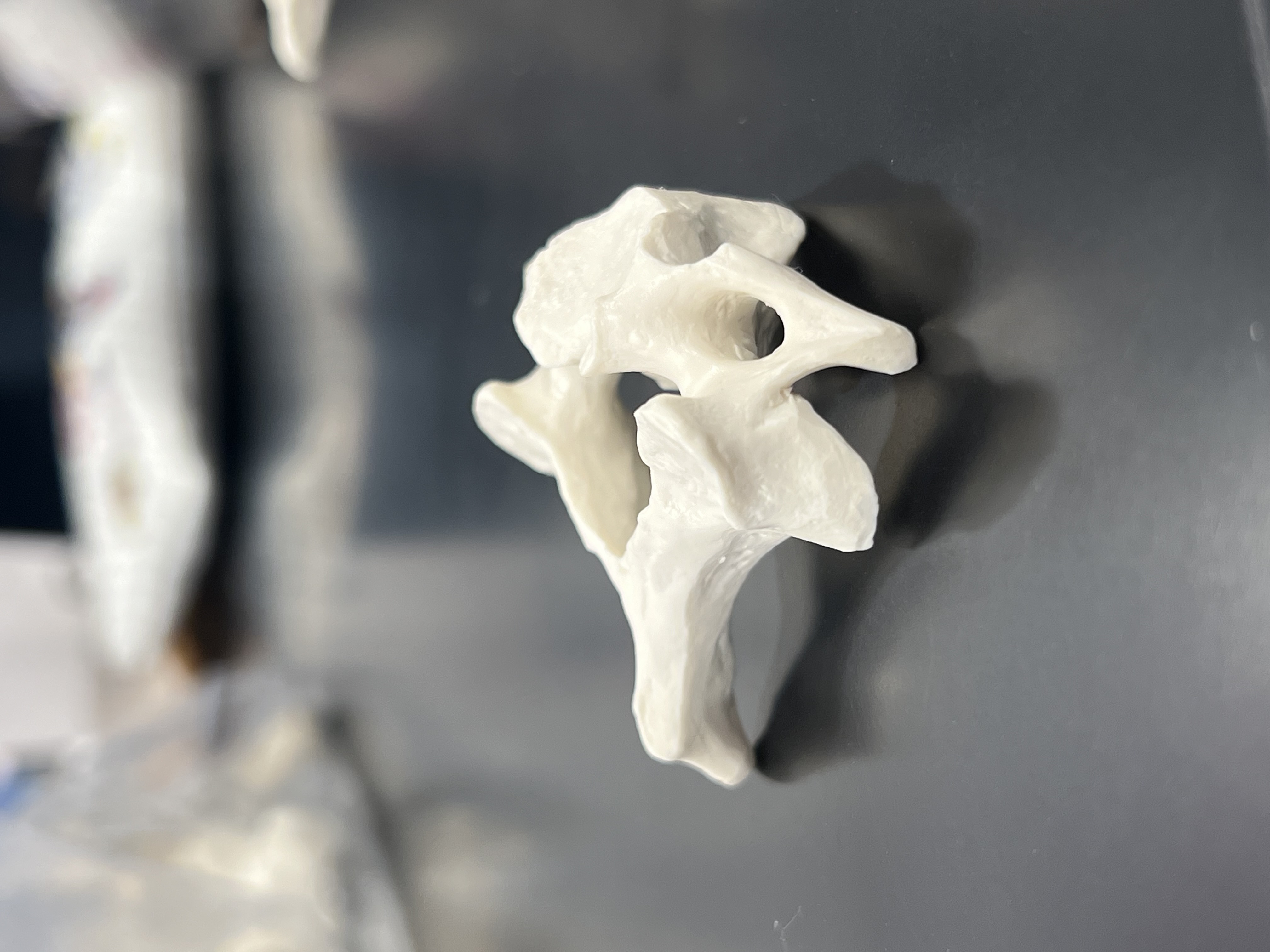 <p>cervical vertebrae</p>
