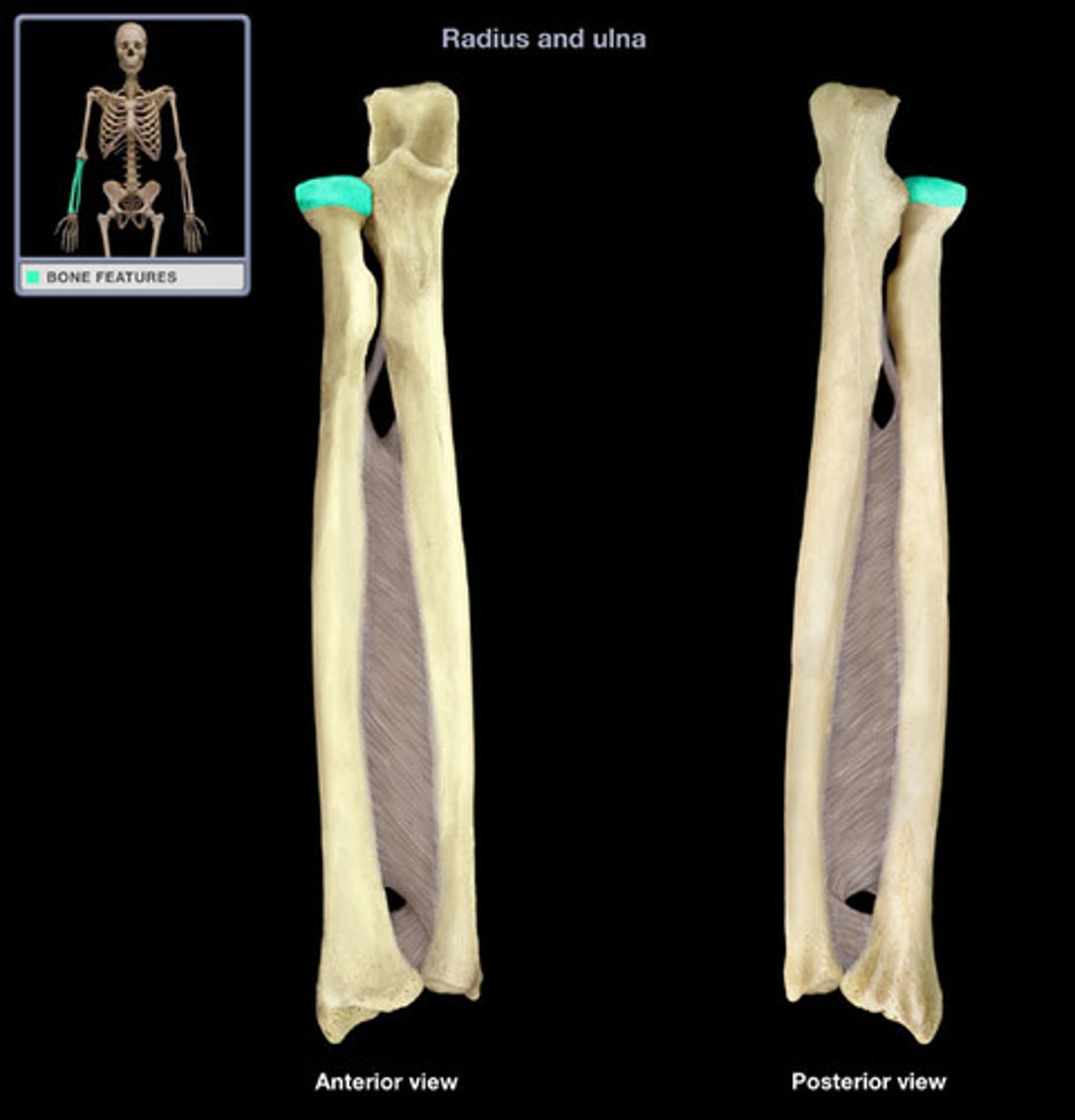 <p>articulates with capitulum of humerus and radial notch of ulna</p>