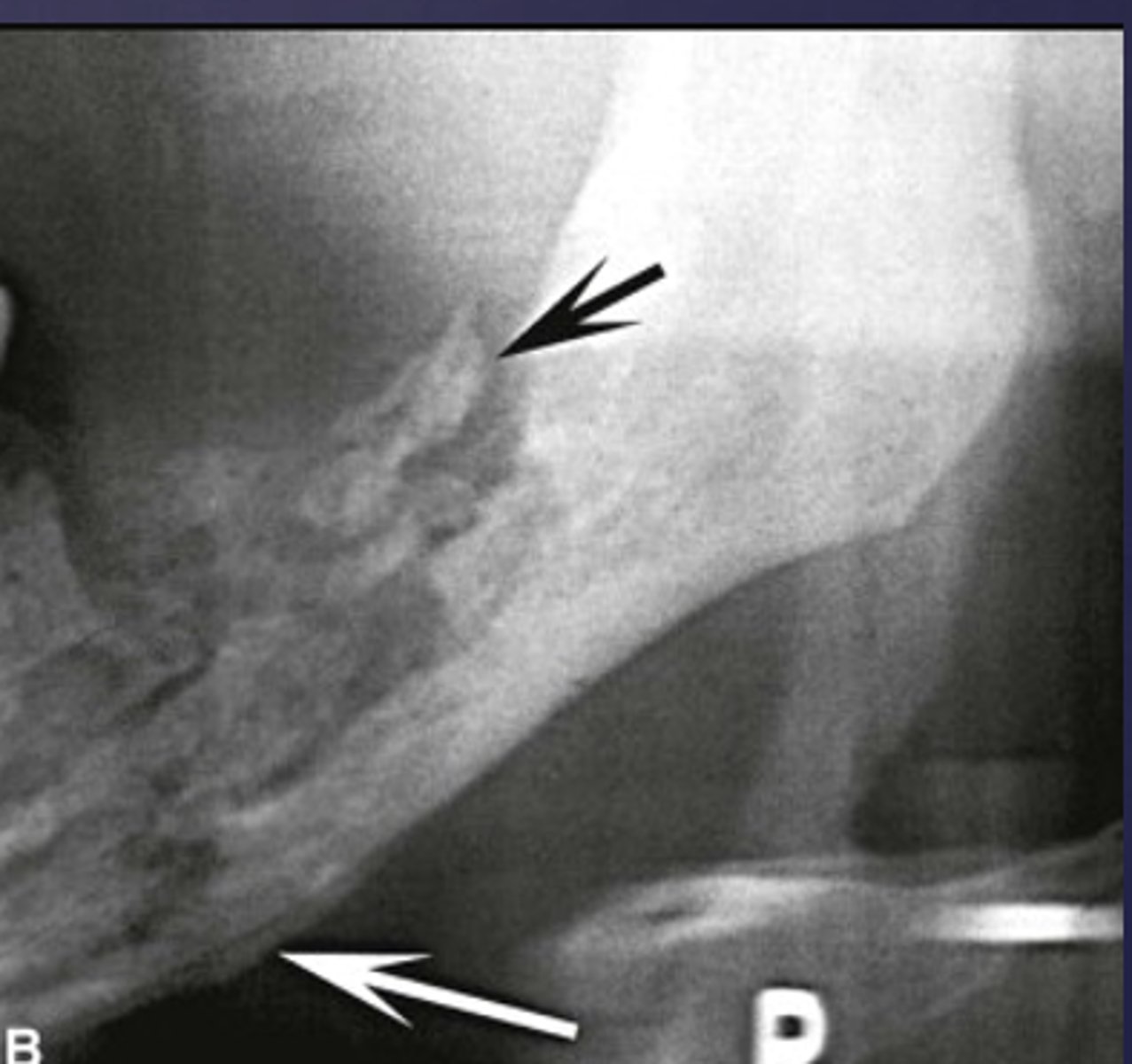 <p>What is the black arrow pointing at?</p>