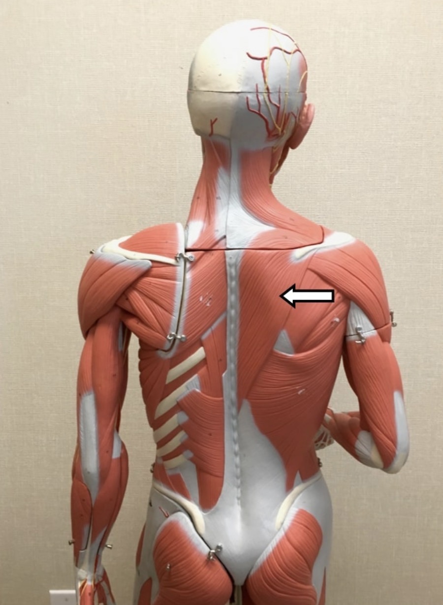 <p>Name the muscle labeled with the white arrow below <span>AND name the insertion</span></p>