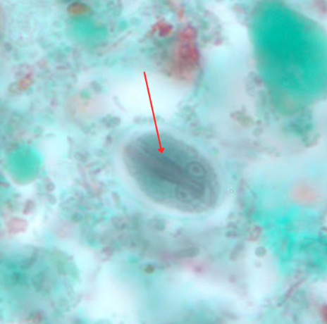 <ul><li><p style="text-align: justify;"><span style="background-color: transparent;"><span>Identify the organism. Give genus and species.</span></span></p><ul><li><p style="text-align: justify;">(1)</p></li></ul></li><li><p style="text-align: justify;"><span style="background-color: transparent;"><span>What is the morphologic stage of the organism?</span></span></p><ul><li><p style="text-align: justify;">(2)</p></li></ul></li><li><p style="text-align: justify;"><span style="background-color: transparent;"><span>Identify the structure pointed by the red arrow.</span></span></p><ul><li><p style="text-align: justify;"><span style="background-color: transparent;"><span>(3)</span></span></p></li></ul></li></ul><p></p>