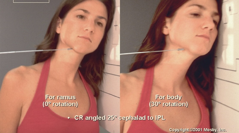 <p>What position is this?</p>
