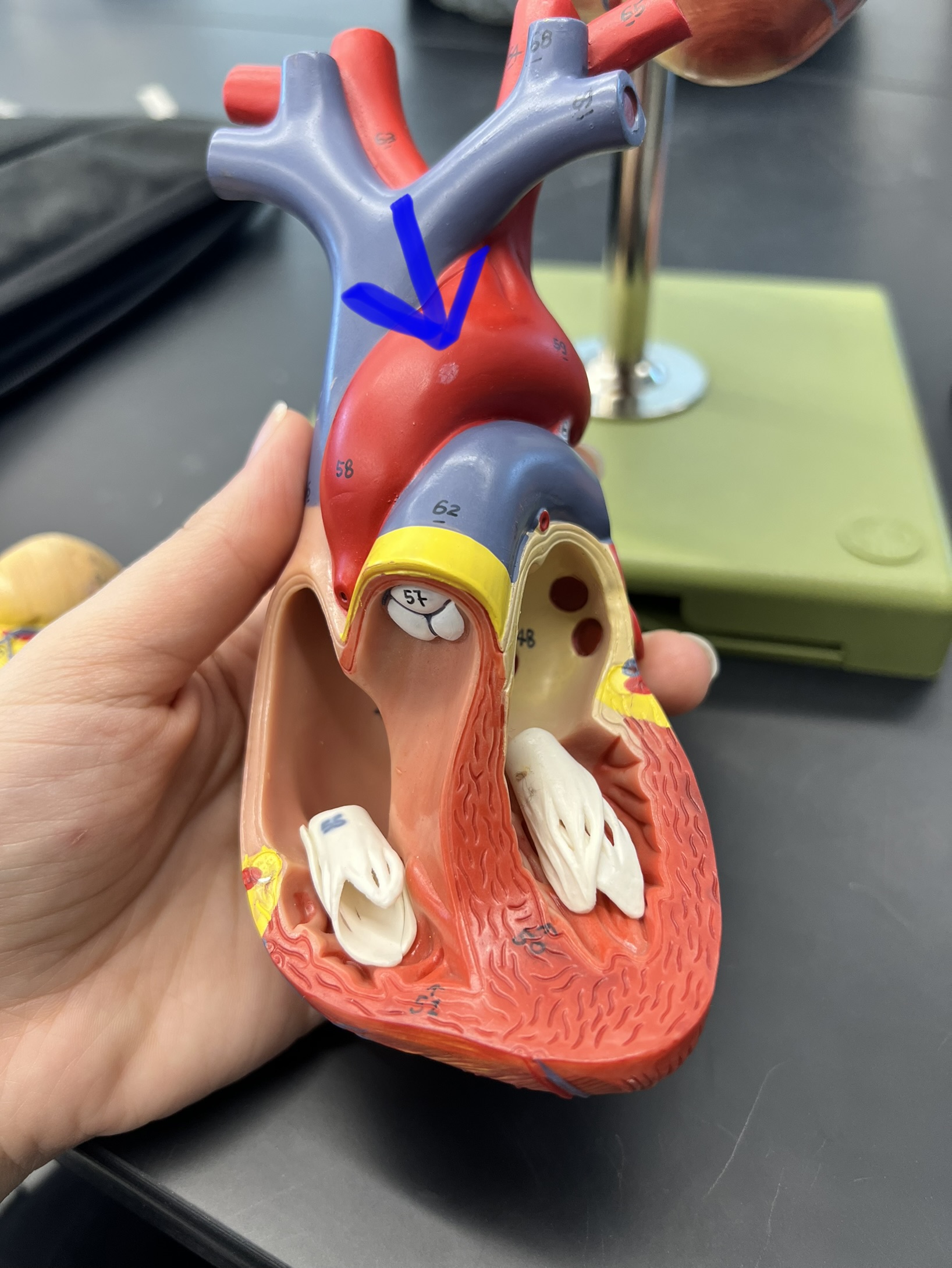 Name the heart structure.