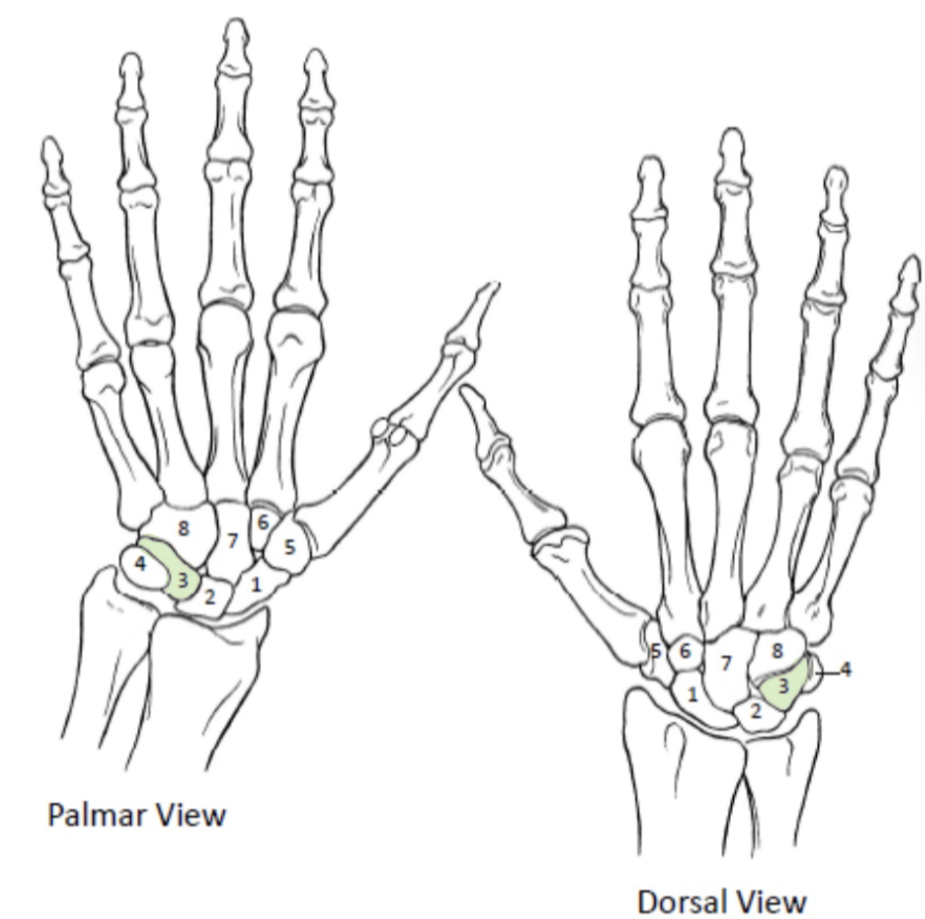 <p>Which Carpal Bones from the proximal row are shown(3)?</p>