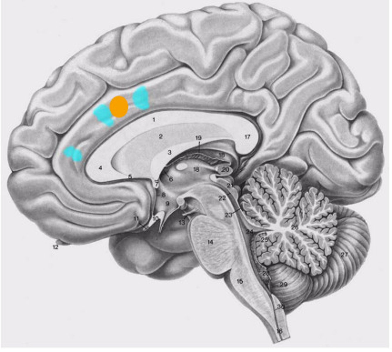 knowt flashcard image