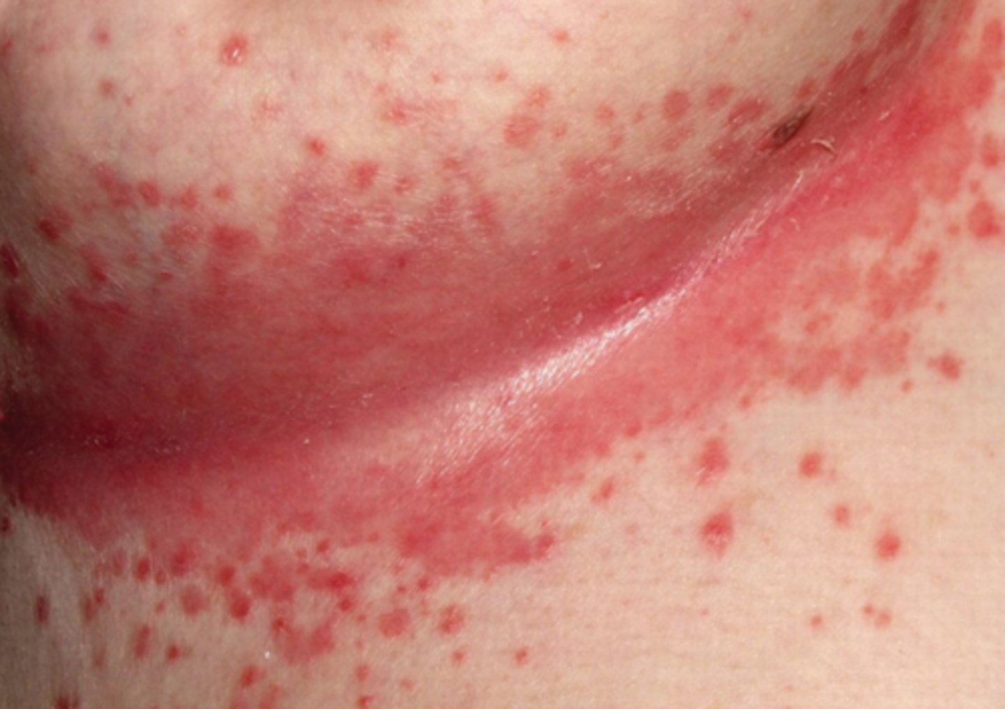 <p>What is the diagnosis?</p>
