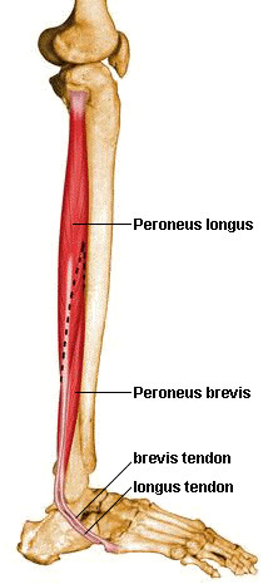 <p>-Origin Upper lateral shaft of fibula</p><p>-Insertion first metatarsal, medial cuneiform</p><p>[same insertion as Tibialis Anterior]</p><p>-Nerve Superficial fibular (peroneal) nerve</p><p>-Actions plantarflexion, eversion,</p><p>-Antagonist Tibialis anterior muscle that does Inversion and Dorsiflexion</p>