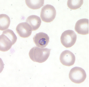 <p>Dr. Vicente Y. Belizario Jr.</p>