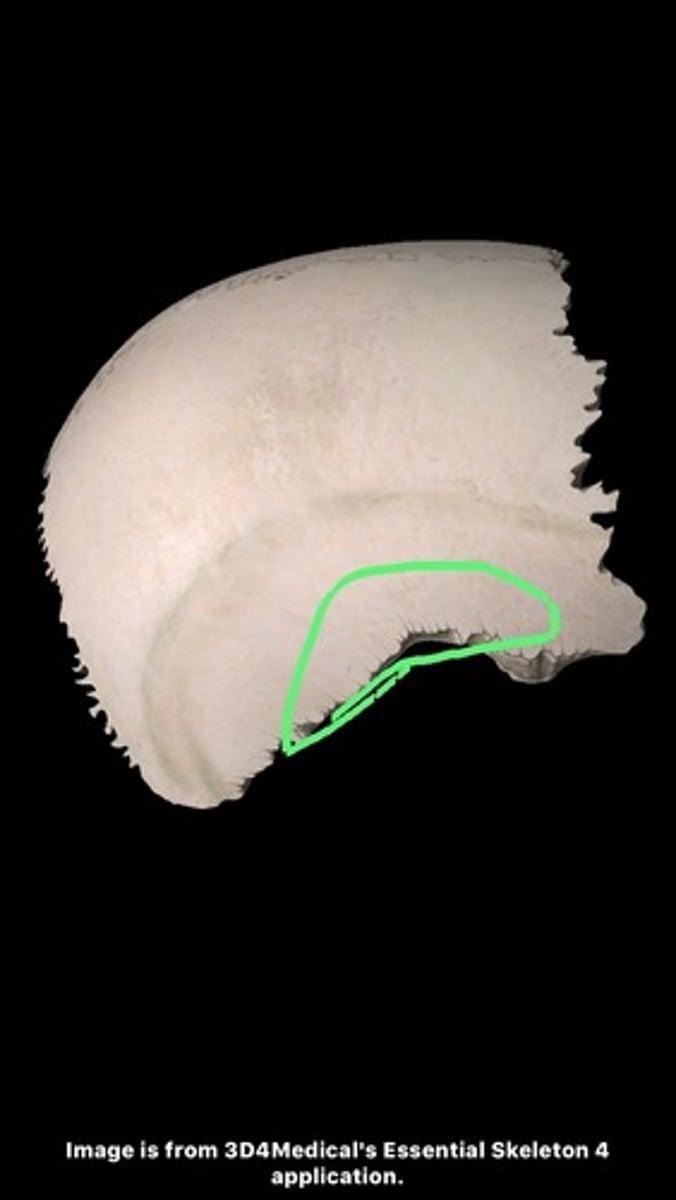 <p>striations that pass posterosuperiorly on the ectocranial surface of the parietal</p>