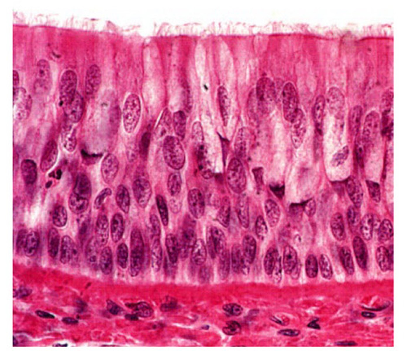 <p>Ciliated pseudostratified columnar epithelium</p>