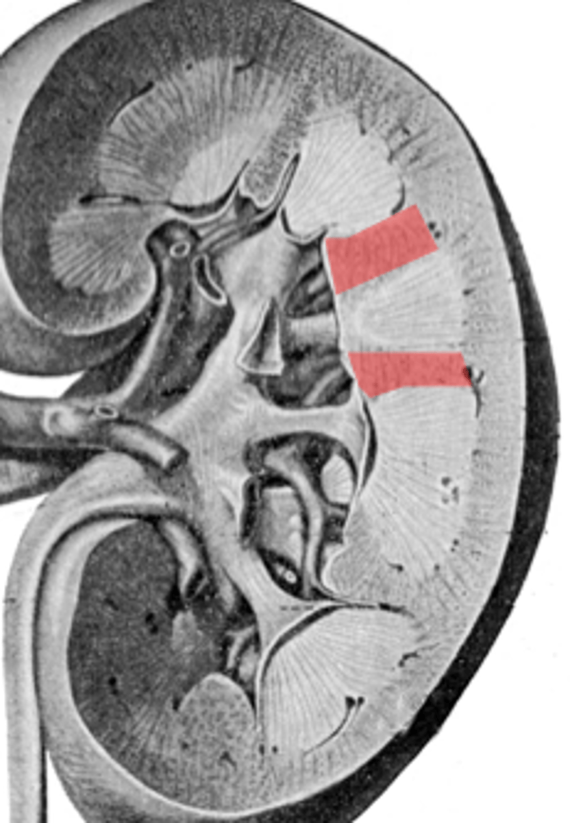 <p>Columns of Bertin (bands of cortical tissue).</p>